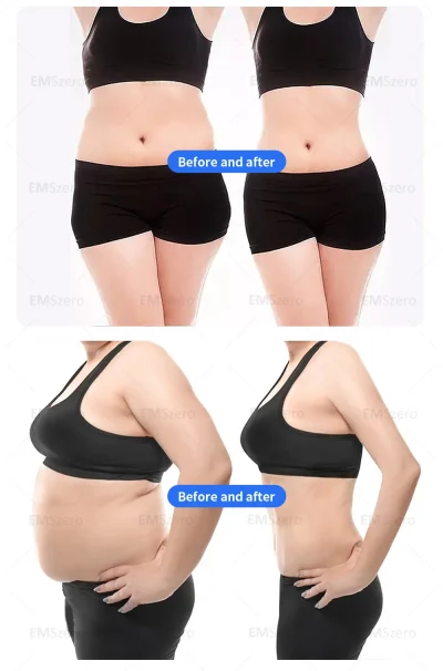 Professional EMS HIEMT Technology Emszero Machine RF with 2 Handle Neo for Muscle Stimulator Body Sculpt - Image 10