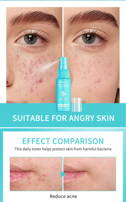 Lakerain Facial First Aid Spray Hypochlorous Skin - Image 2